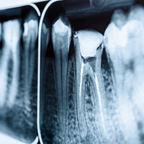Endodoncia Odontek