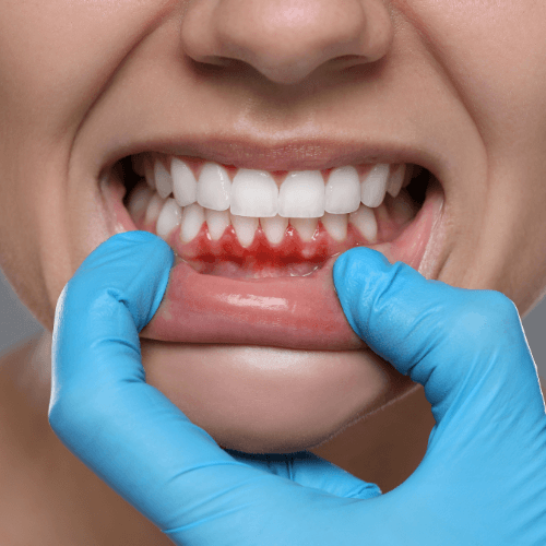 Periodoncia Odontek
